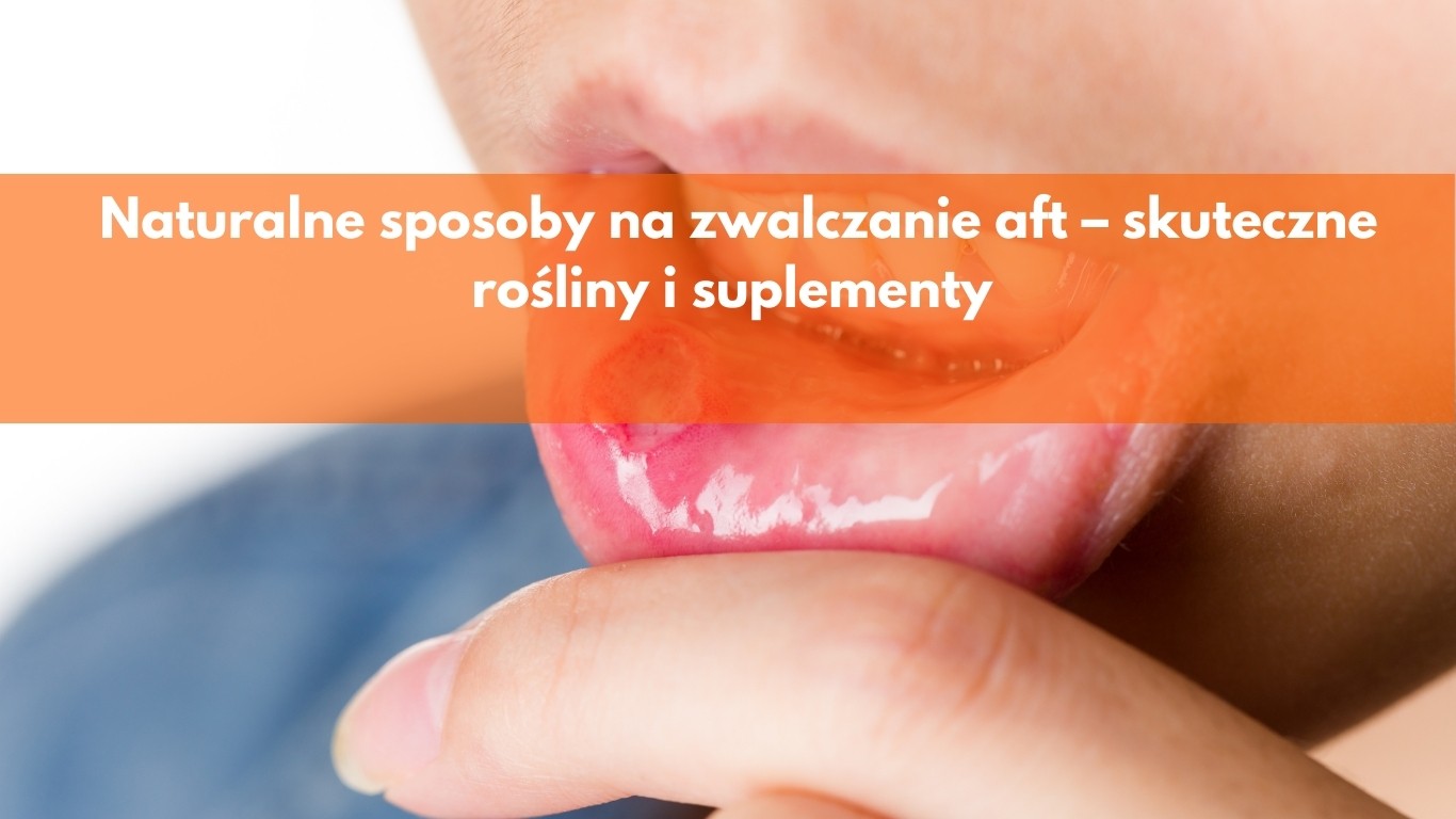 Naturalne sposoby na zwalczanie aft – skuteczne rośliny i suplementy