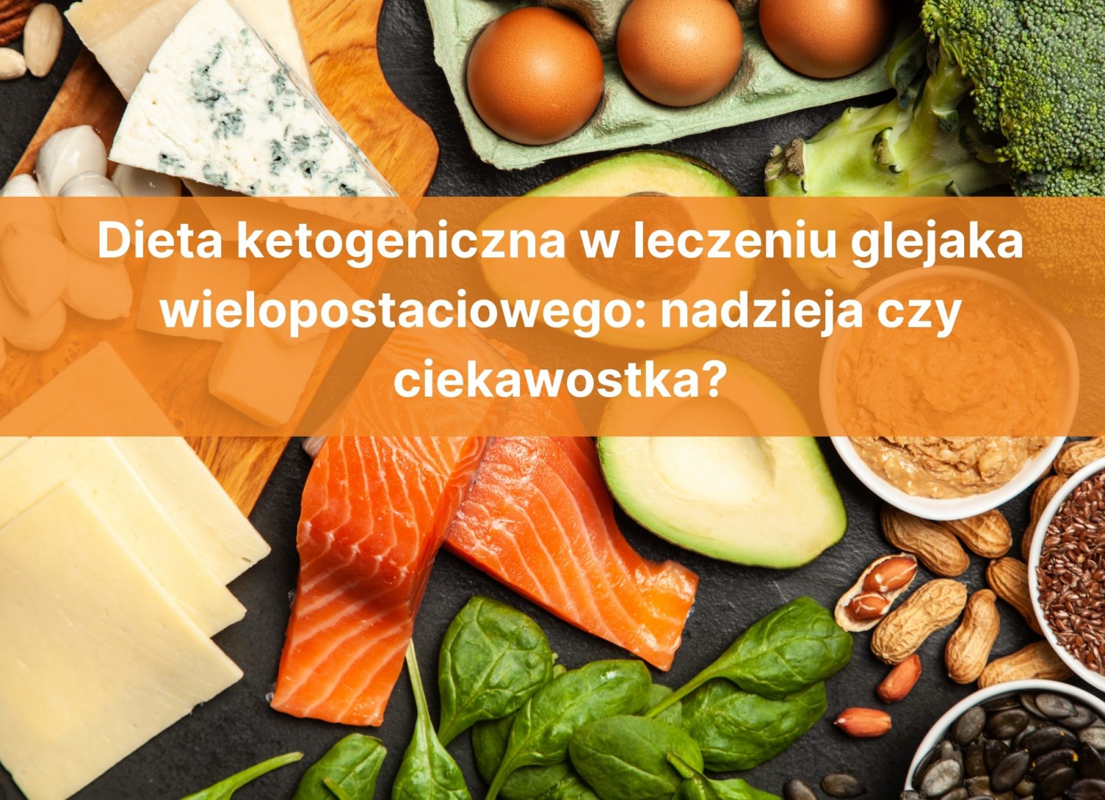 Dieta ketogeniczna w leczeniu glejaka wielopostaciowego: nadzieja czy ciekawostka?