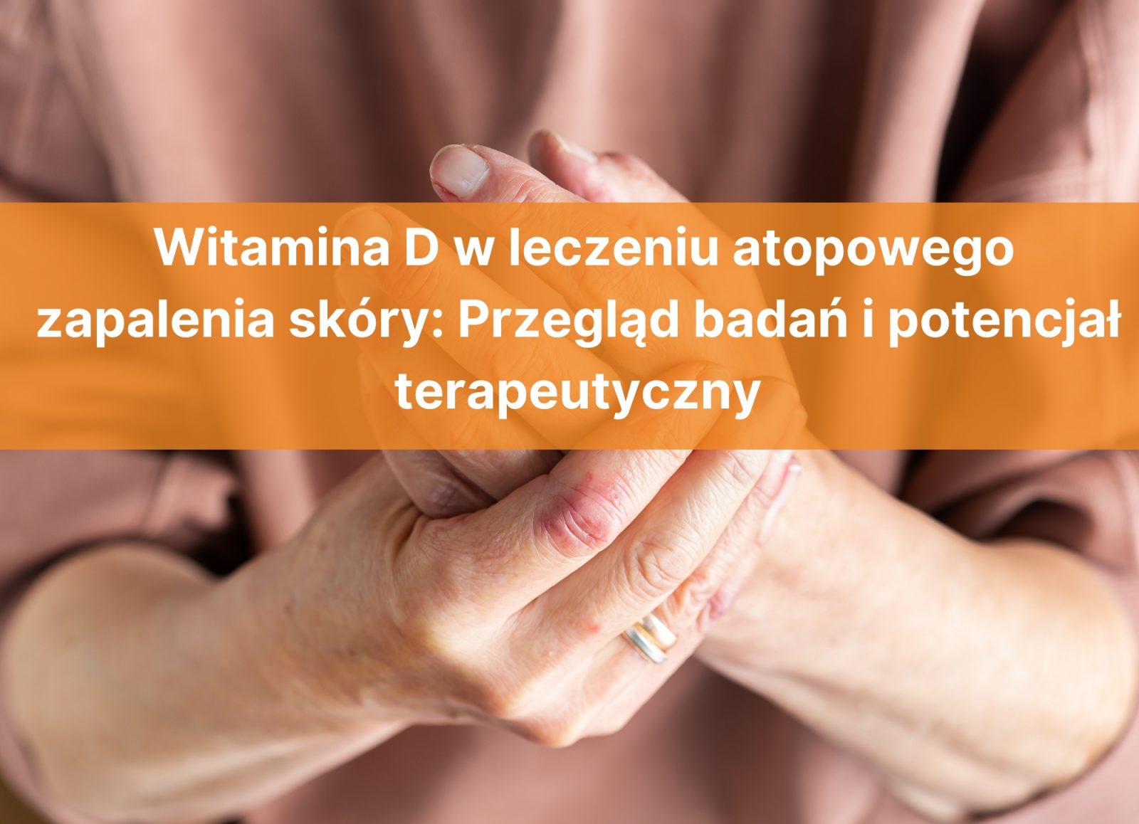 Witamina D w leczeniu atopowego zapalenia skóry: Przegląd badań i potencjał terapeutyczny